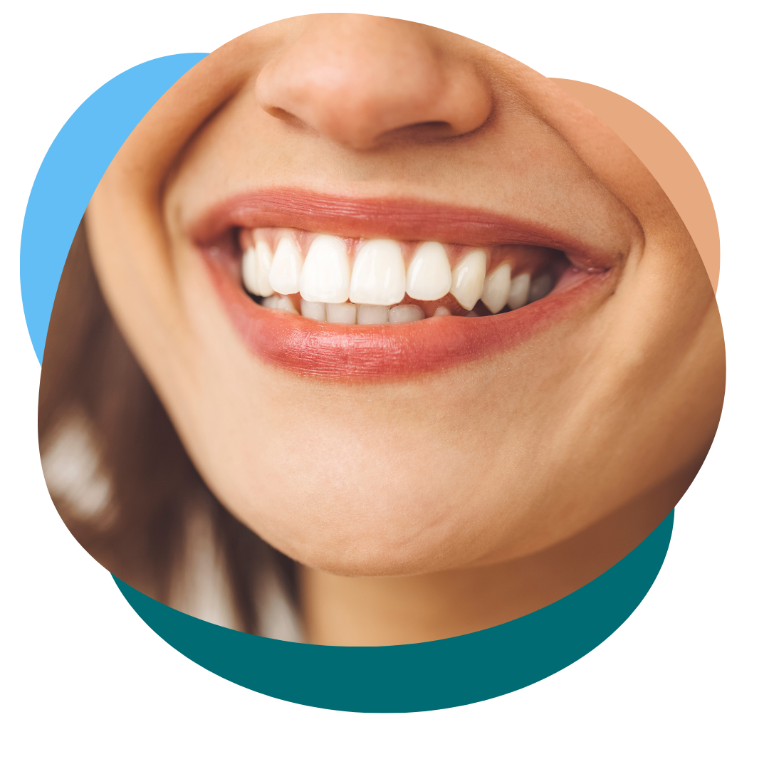 Sourire radieux assurance dentaire